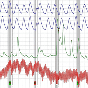 Polygraph Test 